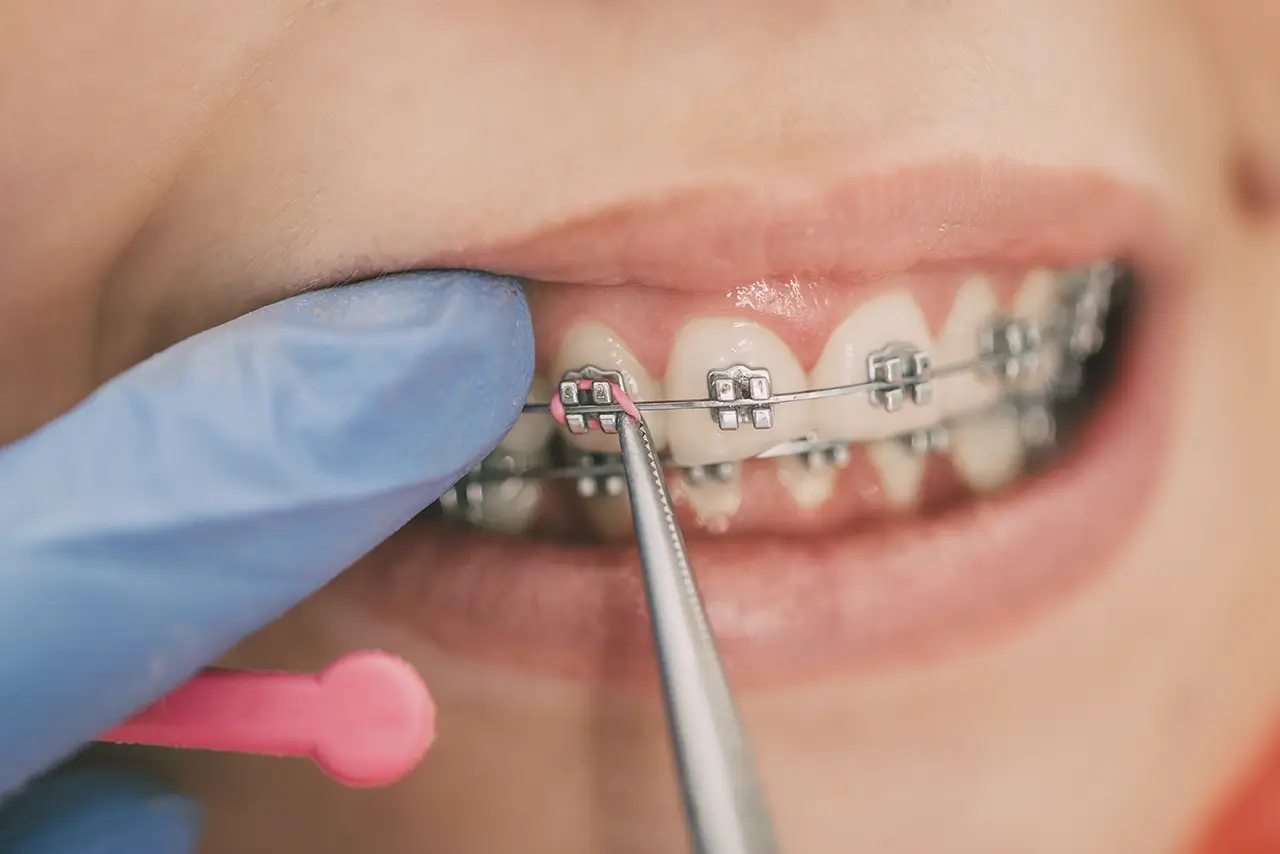 Ortodontia em sapopemba